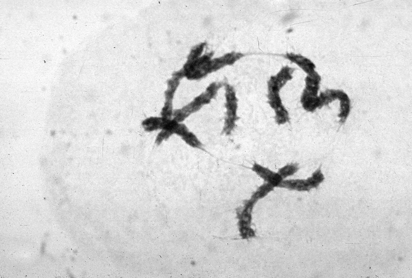 slides of meiosis in Paeonia, Paeonia californica, diakinesis, late