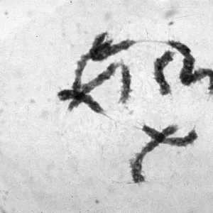 slides of meiosis in Paeonia, Paeonia californica, diakinesis, late
