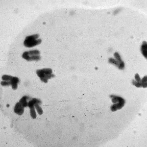 slides of meiosis in Paeonia, Paeonia californica, 1A, non- (6-4)
