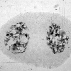 slides of meiosis in Paeonia, Paeonia californica, 11 P non-?, (6-4)